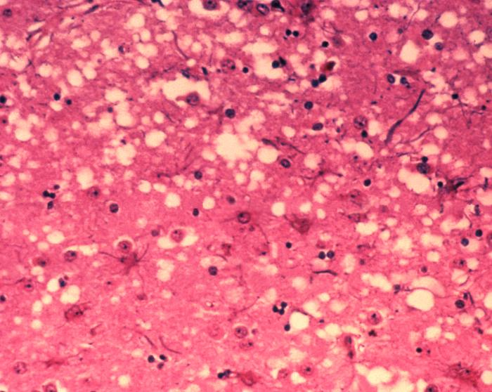 prions-viroids-content-coming-soon-wize-university-biology